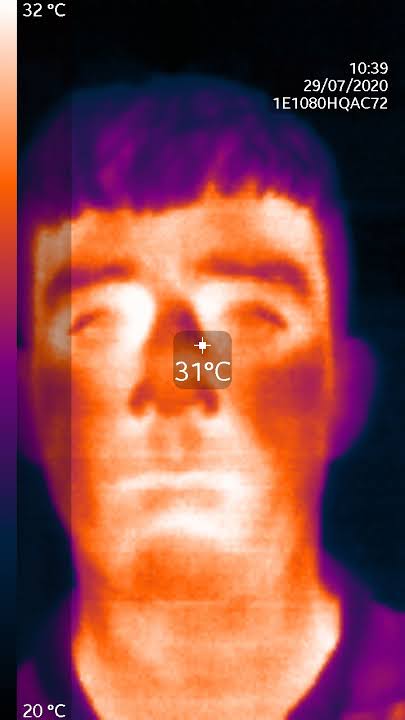 thermal image head shot of a person showing temperature hotspots on face